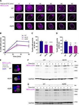 Clearing the JUNQ: the molecular machinery for sequestration, localization, and degradation of the JUNQ compartment